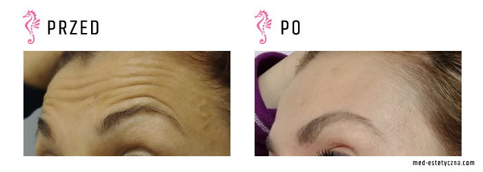 Gabinet dr Joanny Janeckiej najniższe ceny medycyna estetyczna woj. śląskie