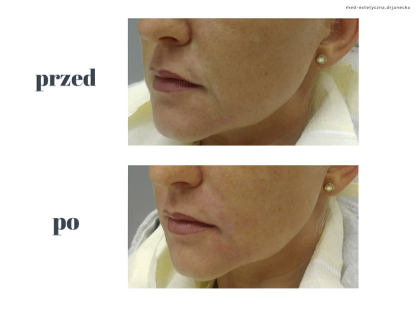 Gabinet dr Joanny Janeckiej najniższe ceny medycyna estetyczna woj. śląskie