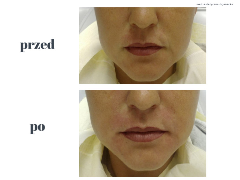 Gabinet dr Joanny Janeckiej najniższe ceny medycyna estetyczna woj. śląskie