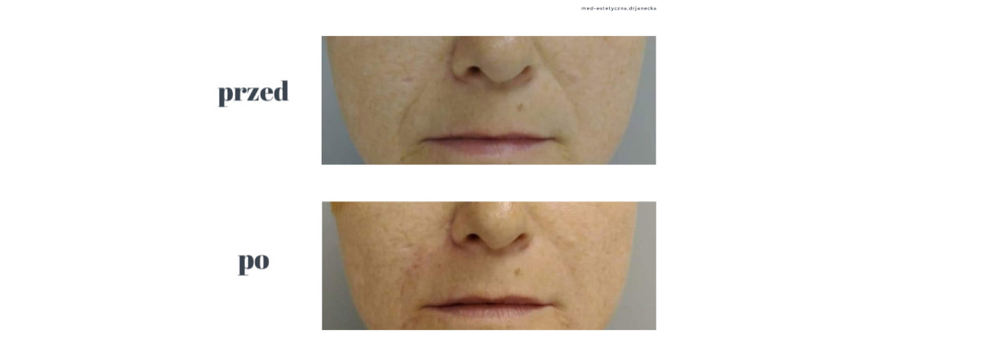 Gabinet dr Joanny Janeckiej najniższe ceny medycyna estetyczna woj. śląskie