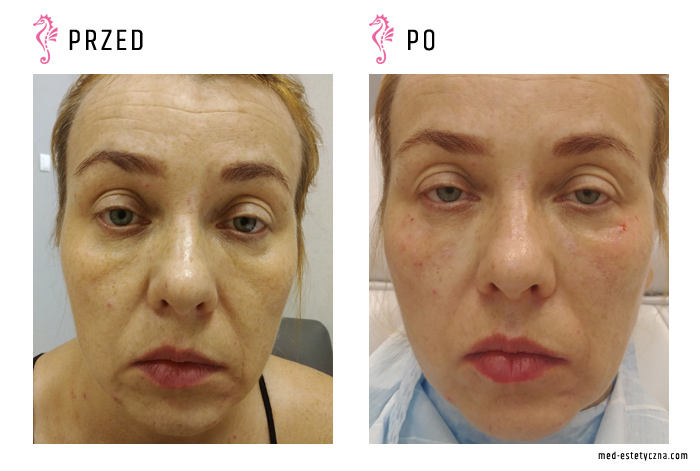 Gabinet dr Joanny Janeckiej najniższe ceny medycyna estetyczna woj. śląskie