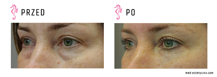 Gabinet dr Joanny Janeckiej najniższe ceny medycyna estetyczna woj. śląskie