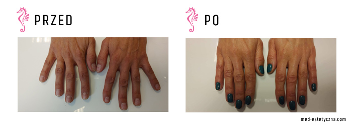 Gabinet dr Joanny Janeckiej najniższe ceny medycyna estetyczna woj. śląskie