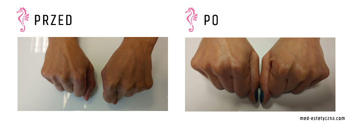 Gabinet dr Joanny Janeckiej najniższe ceny medycyna estetyczna woj. śląskie