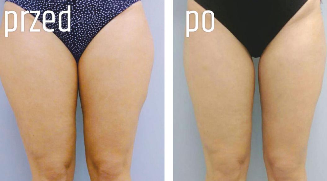 Gabinet dr Joanny Janeckiej najniższe ceny medycyna estetyczna woj. śląskie