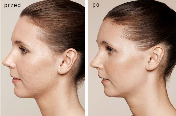 Gabinet dr Joanny Janeckiej najniższe ceny medycyna estetyczna woj. śląskie