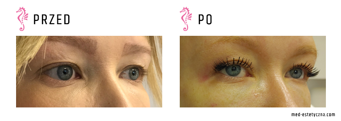 Gabinet dr Joanny Janeckiej najniższe ceny medycyna estetyczna woj. śląskie