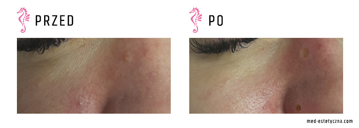 Gabinet dr Joanny Janeckiej najniższe ceny medycyna estetyczna woj. śląskie