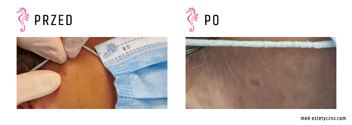 Gabinet dr Joanny Janeckiej najniższe ceny medycyna estetyczna woj. śląskie