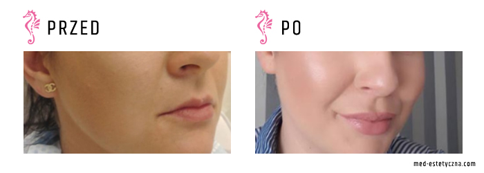 Gabinet dr Joanny Janeckiej najniższe ceny medycyna estetyczna woj. śląskie