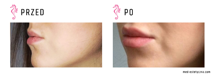 Gabinet dr Joanny Janeckiej najniższe ceny medycyna estetyczna woj. śląskie