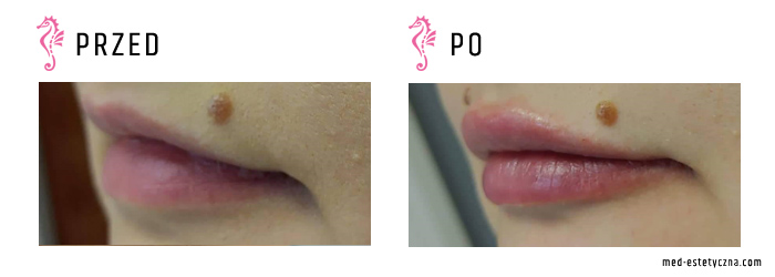 Gabinet dr Joanny Janeckiej najniższe ceny medycyna estetyczna woj. śląskie