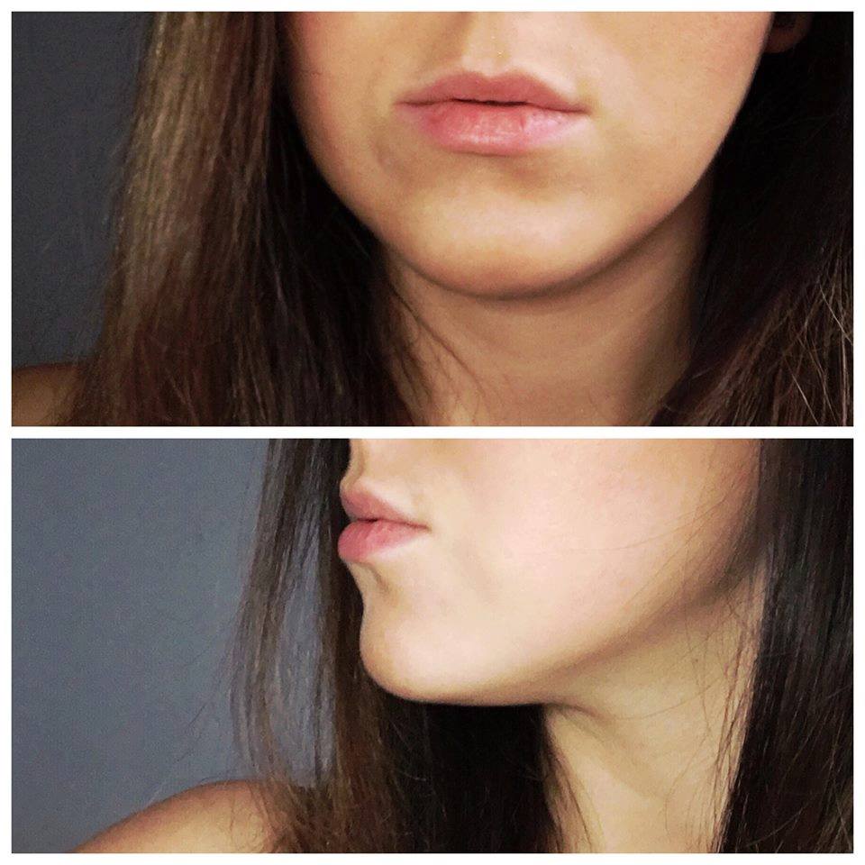 Gabinet dr Joanny Janeckiej najniższe ceny medycyna estetyczna woj. śląskie